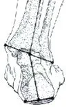 Skate Blade Alignment
